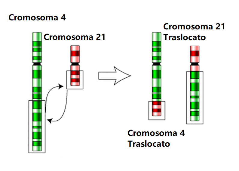 Traslocazione robertsoniana