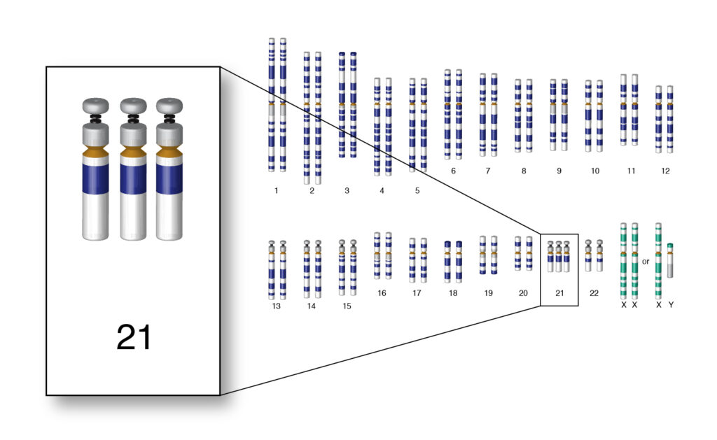 Trisomia 21